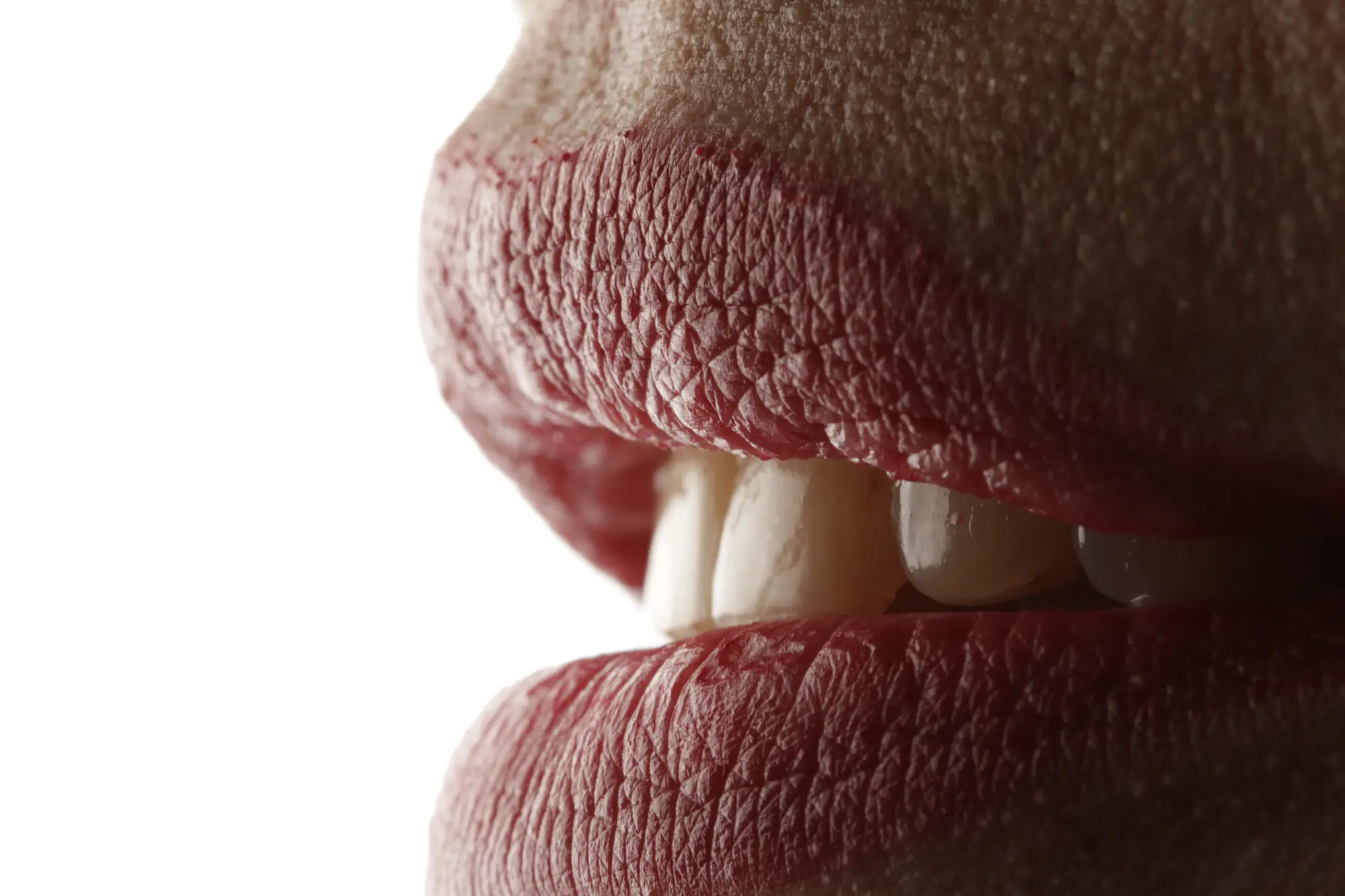 Fotografía intraoral clínica