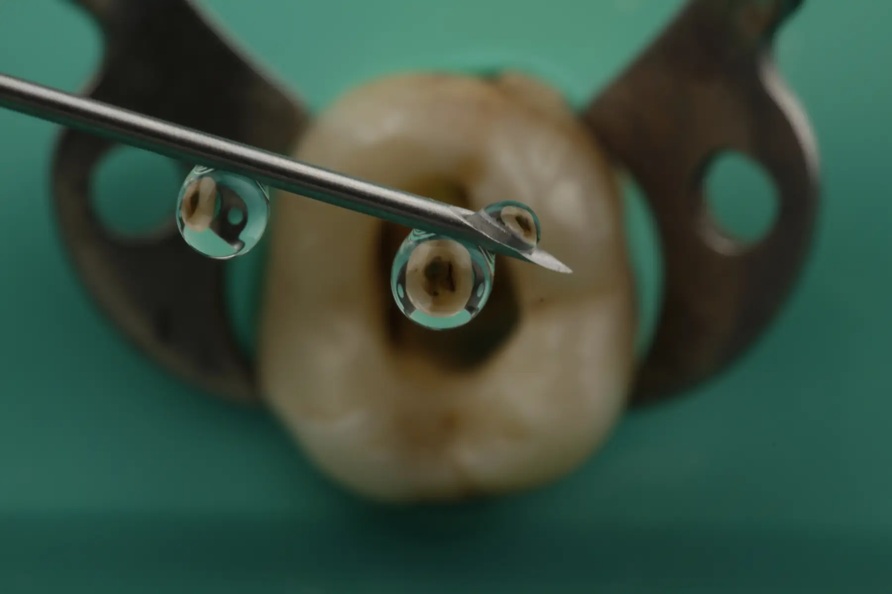 Fotografía dental artística