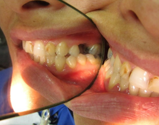 Foto dental sin técnica profesional