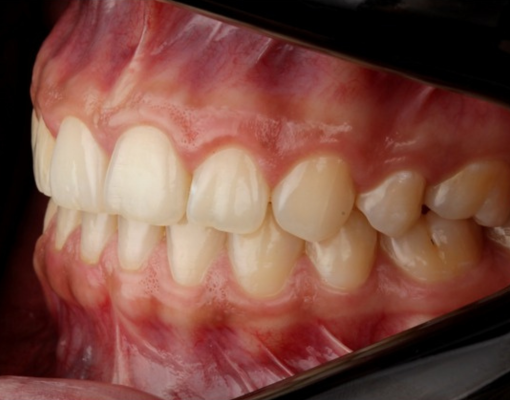 Galería ODONTOSHOT