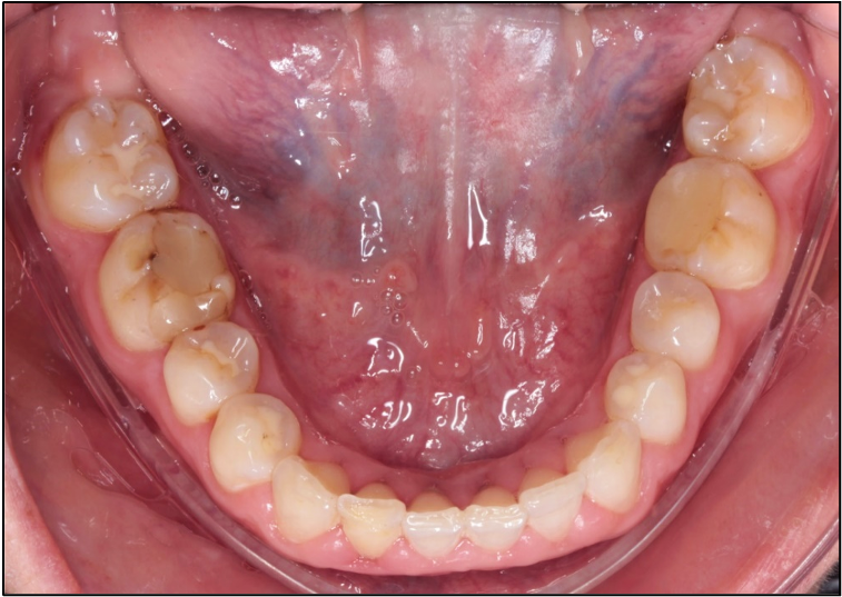 Galería ODONTOSHOT