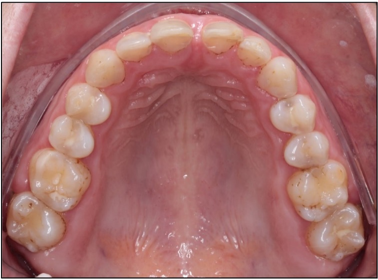 Galería ODONTOSHOT