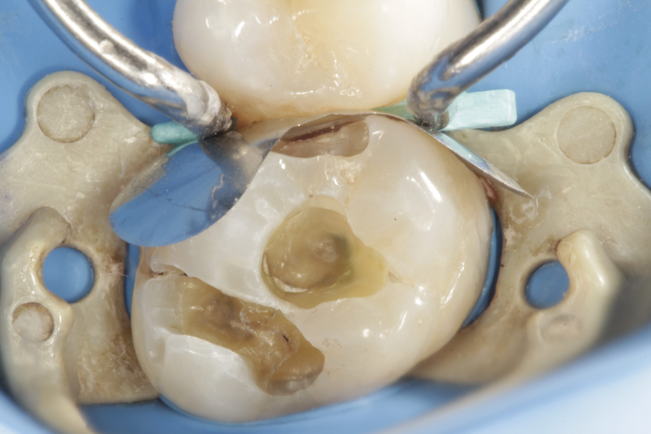 Rehabilitación oral
